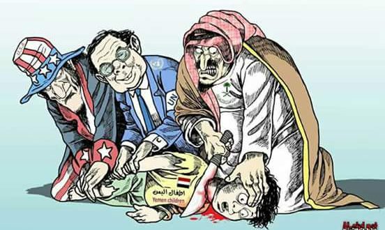 سفاح آل سعود يذبح اطفال اليمن بمساندة اميركية بريطانية