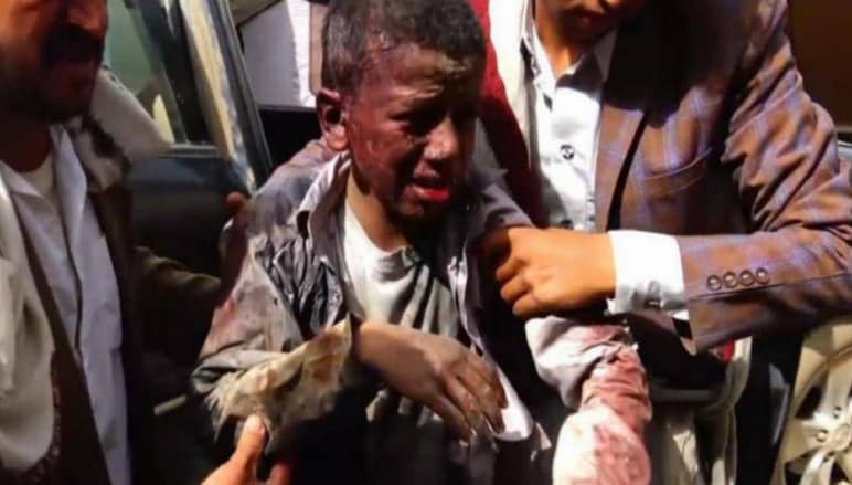 ائتلاف 14 فبراير يستنكر حذف «غوتيريش» لتحالف العدوان على اليمن من القائمة السوداء لقتل الأطفال