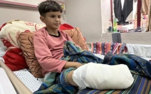 الأونروا: الأطفال في غزّة يفقدون أطرافهم ويخضعون لعمليّات جراحيّة دون تخدير