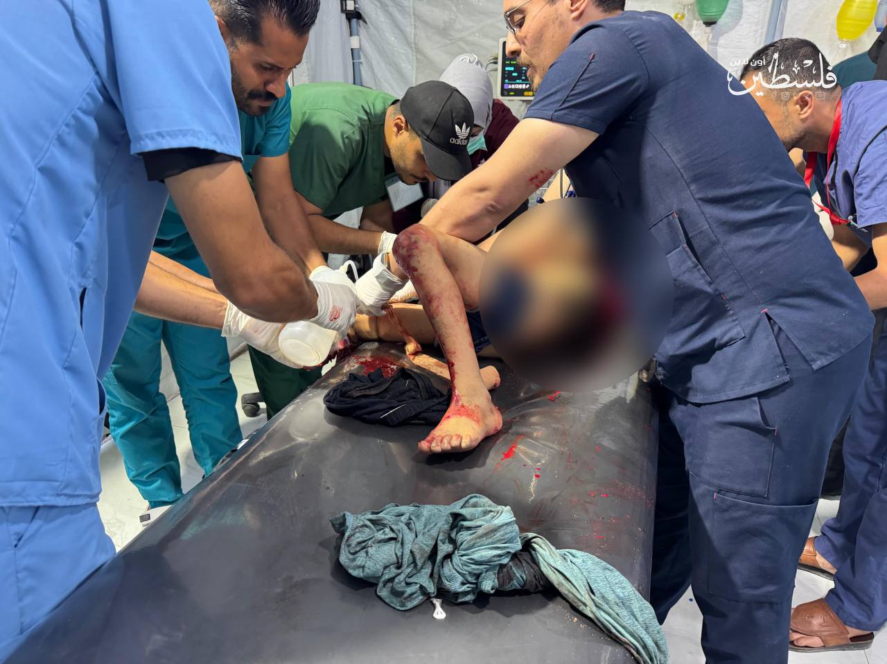 الصحّة الفلسطينيّة: 248 شهيدًا وجريحًا في غزّة خلال 24 ساعة