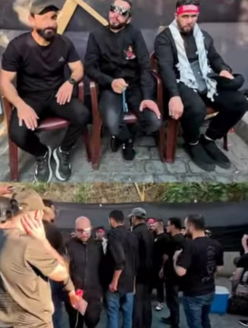 عدد من جرحى «البايجر» في ضيافة «مضيف شهداء البحرين»