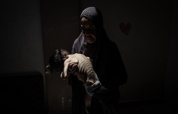 في ظلّ سيطرة الكيان الصهيونيّ على المعابر.. المجاعة تفتك بأطفال غزّة